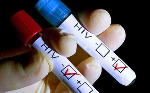 HIV-3